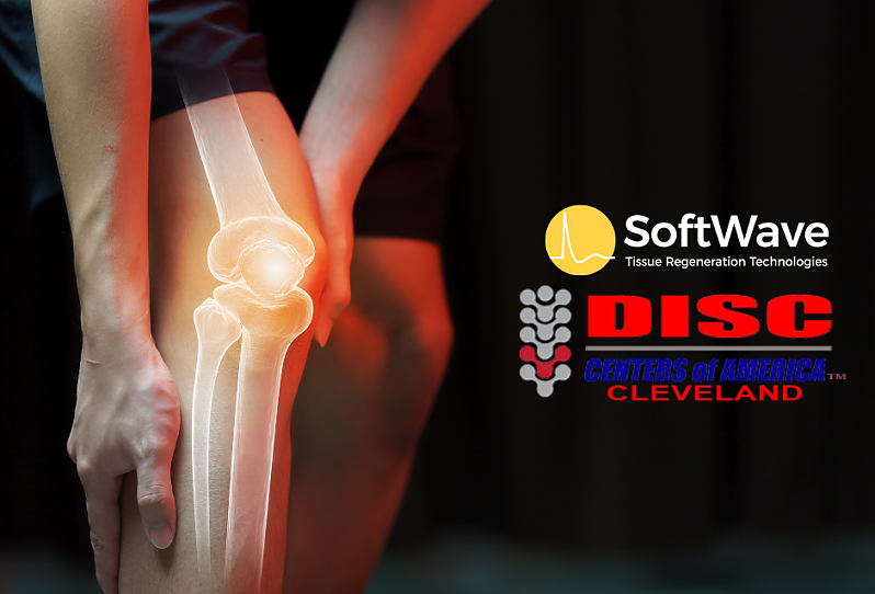 Knee Pain Making Life Miserable? A Breakthrough Treatment Now Available in Cleveland